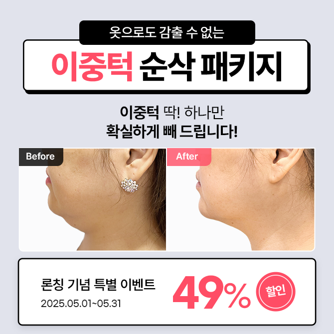 이중턱패키지